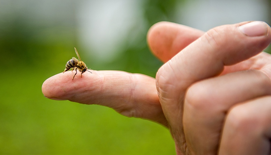 What is anaphylaxis?